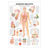 Lehrtafel Diabetes Mellitus, LxB 100x70 cm, Nicht Laminiert