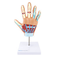 Handmodell mit rheumatoider Arthritis Heinescientific (1 Stück) , Detailansicht