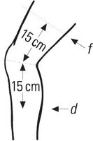 Bort StabiloGen Eco Fixationsb m.Silikonpel.haut Gr.XL plus