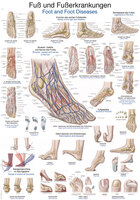 Anatomische Lehrtafel Fuß und Fußerkrankungen Erlerzimmer 70 x 100 cm Kunststoff-Folie mit Metallbeleistung (1 Stück), Detailansicht