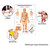 Körperakupunktur II Mini-Poster Anatomie 34x24 cm medizinische Lehrmittel, Laminiert