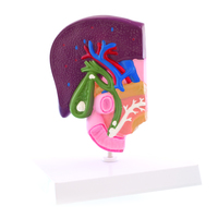 Anatomisches Modell der Gallenblase mit ihren Erkrankungen Heinescientific (1 Stück) , Detailansicht